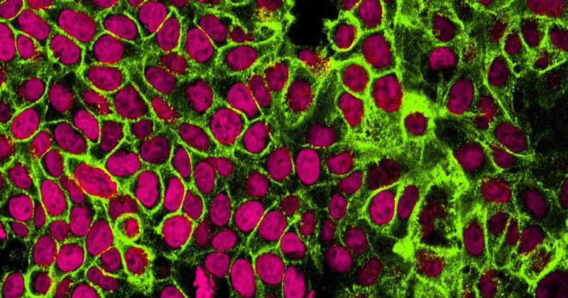 Az új módszer azonnal képes észlelni a rák rejtett jeleit, ráadásul soha nem látott precizitással.