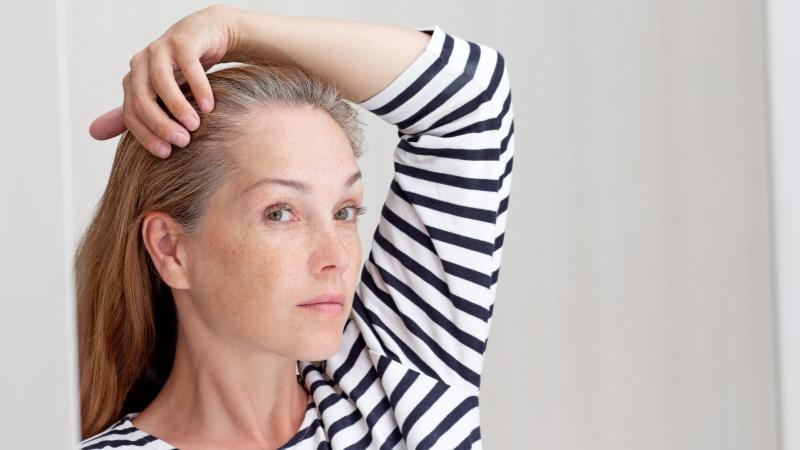 Íme három kreatív módszer, amivel természetes módon eltüntetheted az ősz hajszálaidat:

1. **Hennás hajfestés**: A henna nemcsak szép, vörös árnyalatú színt ad, hanem tápláló hatása is van a hajra. Keverj össze hennaport vízzel, és hagyd állni egy ideig, 